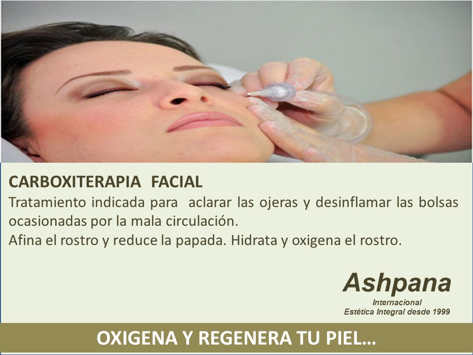 para q sirve la carboxiterapia facial